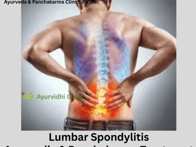 Ayurvedic & Panchakarma Treatment of Lumbar Spondylitis: Healing Lower Back Pain Naturally