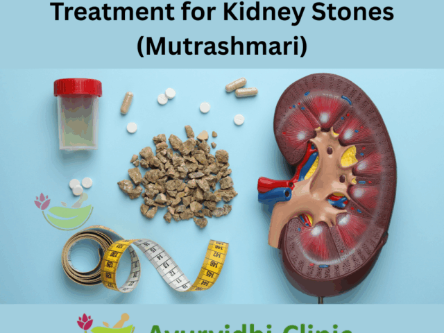 Ayurvedic & Panchakarma Treatment for Kidney Stones (Mutrashmari)