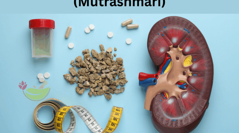 Ayurvedic & Panchakarma for kidney stone treatment at Ayurvidhi Clinic in Pune
