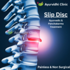 Ayurvidhi Clinic image showing a detailed spine with a highlighted slipped disc area, representing Ayurvedic and Panchakarma treatment for slip disc pain relief without surgery.