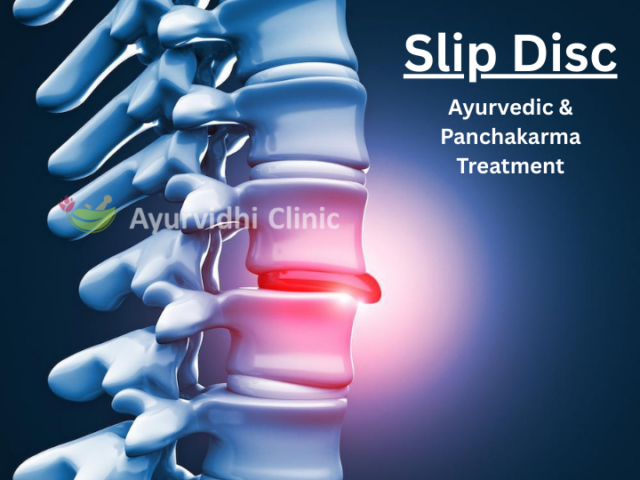 Slip Disc Relief Naturally: Ayurveda & Panchakarma Care