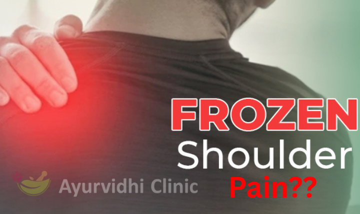 create an alt text for the image and also SEO-Optimized Caption to mention in WordPress, GMB description, SEO-optimized filename, Short caption for Instagram, Image Description (for blog SEO) & hashtag