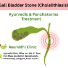 “Gall bladder stone (cholelithiasis) illustration showing stones in the gallbladder with pain indication and Ayurvedic Panchakarma treatment at Ayurvidhi Clinic Pune.”