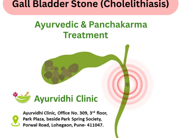 Ayurvedic Treatment for Gall Bladder Stones (Cholelithiasis) Without Surgery